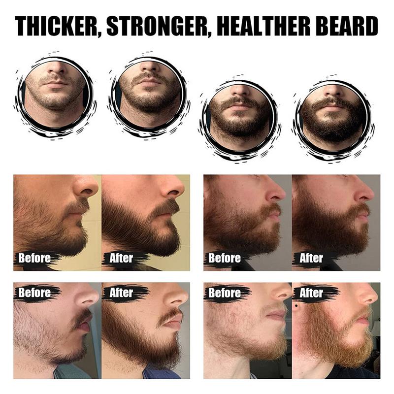 5pcs Men Beard Barba Grooming  – Men'S Grooming Tonic recenzja i cena
